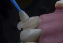 How Much Do Dental Implants Cost in Istanbul? 2026 Price Guide How Much Do Dental Implants Cost in Istanbul? 20
