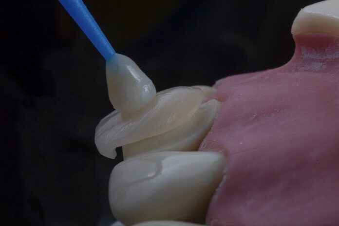 istanbul-guidebook-346 How Much Do Dental Implants Cost in Istanbul? 20