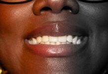 Veneers in Istanbul: Cost, Quality, and the “Turkey Teeth” Truth Veneers in Istanbul: Cost, Quality, and the "Tur
