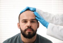 Hair Transplant Types Explained: FUE vs DHI vs Sapphire in Istanbul Doctor examining a patient's scalp at a hair transplant clinic in Istanbul