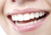 Hollywood Smile in Istanbul: Cost, Process, and Is It Worth It? Bright white smile after Hollywood smile dental treatment in Istanbul