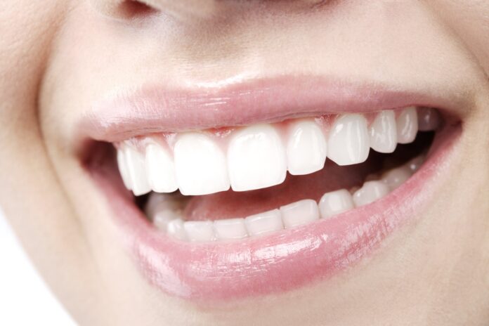Bright white smile after Hollywood smile dental treatment in Istanbul
