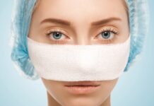 Recovering from Rhinoplasty in Istanbul: Day-by-Day Timeline Patient with post-rhinoplasty nose support and bandages